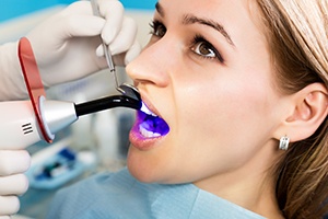 Dentist curing tooth-colored filling with UV light